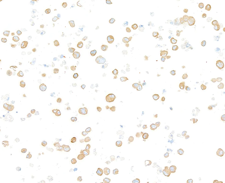 Immunocytochemistry - Anti-beta-Tubulin antibody [BLR236K] - BSA free (AB314069)