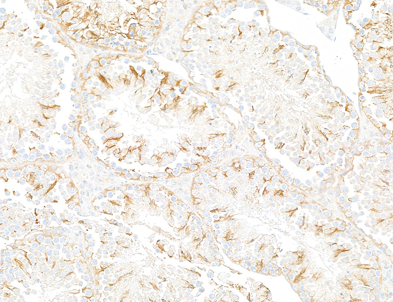 Immunohistochemistry (Formalin/PFA-fixed paraffin-embedded sections) - Anti-beta-Tubulin antibody [BLR236K] - BSA free (ab314069), expandable thumbnail