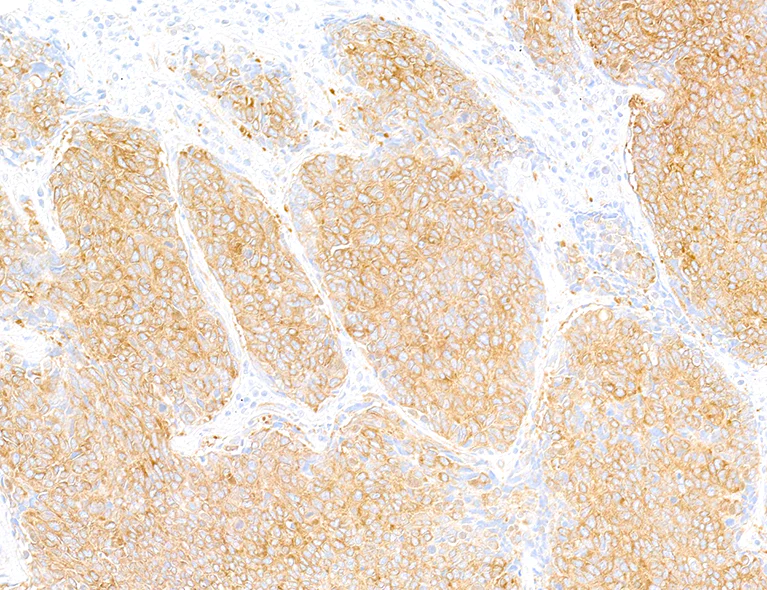 Immunohistochemistry (Formalin/PFA-fixed paraffin-embedded sections) - Anti-beta-Tubulin antibody [BLR236K] - BSA free (AB314069)