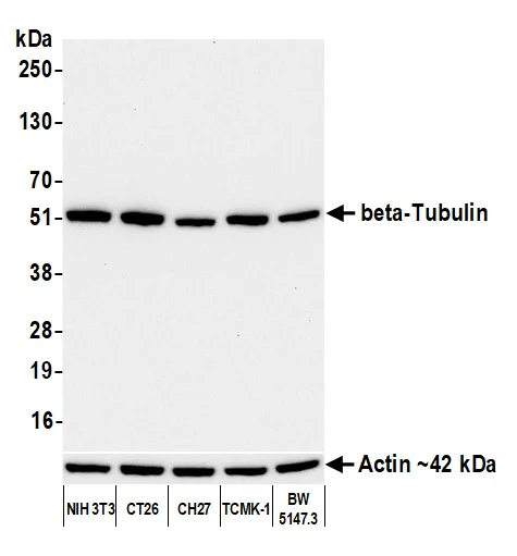 Western blot - Anti-beta-Tubulin antibody [BLR236K] - BSA free (AB314069)