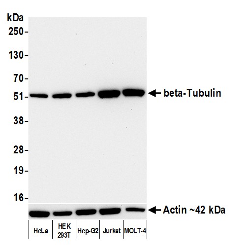 Western blot - Anti-beta-Tubulin antibody [BLR236K] - BSA free (AB314069), expandable thumbnail