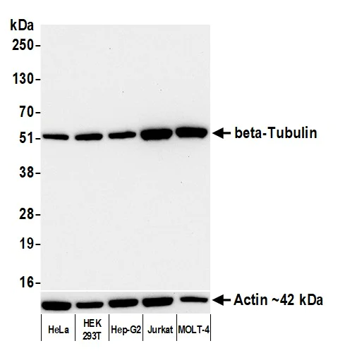 Western blot - Anti-beta-Tubulin antibody [BLR236K] - BSA free (AB314069)