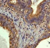 Immunohistochemistry (Formalin/PFA-fixed paraffin-embedded sections) - Anti-beta Tubulin antibody [EP1331Y] - Microtubule Marker (AB52901), expandable thumbnail