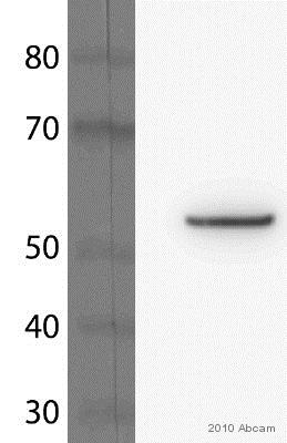 Western blot - Anti-beta Tubulin antibody [EP1331Y] - Microtubule Marker (AB52901), expandable thumbnail