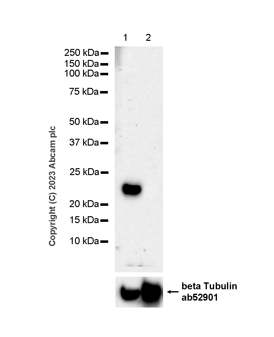 Western blot - Anti-beta Tubulin antibody [EP1331Y] - Microtubule Marker (ab52901), expandable thumbnail