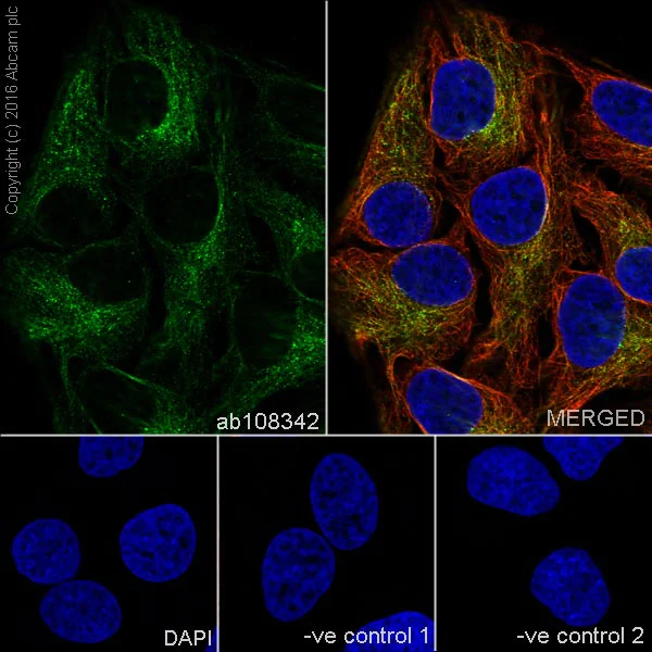 Immunocytochemistry/ Immunofluorescence - Anti-beta Tubulin antibody [EPR1330] - BSA and Azide free (AB226028)