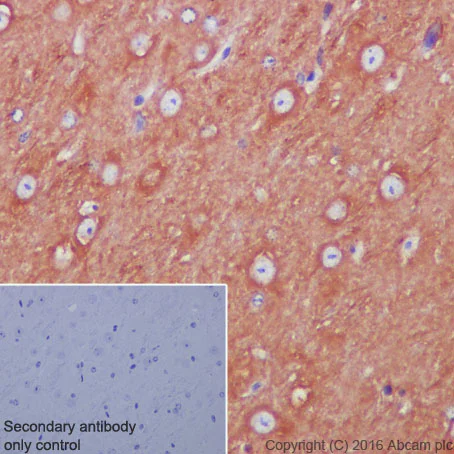Immunohistochemistry (Formalin/PFA-fixed paraffin-embedded sections) - Anti-beta Tubulin antibody [EPR1330] - BSA and Azide free (AB226028)