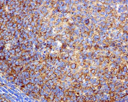 Immunohistochemistry (Formalin/PFA-fixed paraffin-embedded sections) - Anti-beta Tubulin antibody [EPR1330] - BSA and Azide free (AB226028)