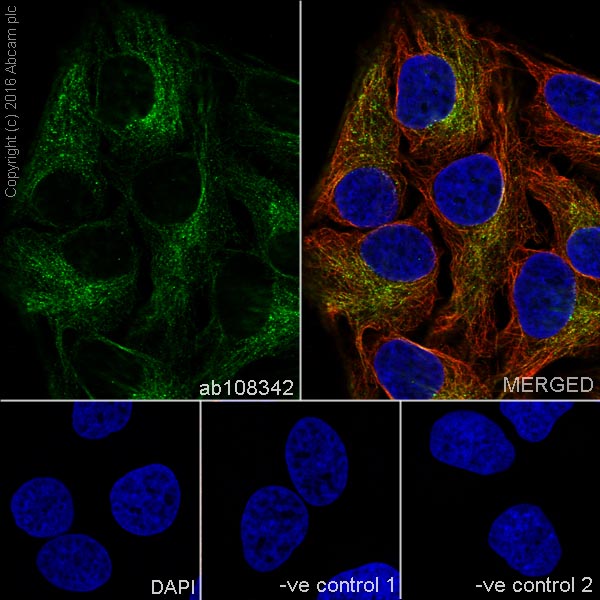Immunocytochemistry/ Immunofluorescence - Anti-beta Tubulin antibody [EPR1330] - Microtubule Marker (AB108342), expandable thumbnail