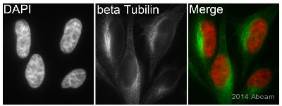 Immunocytochemistry/ Immunofluorescence - Anti-beta Tubulin antibody [EPR1330] - Microtubule Marker (ab108342), expandable thumbnail