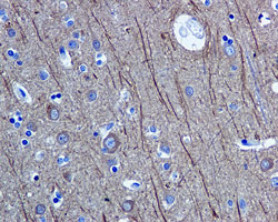 Immunohistochemistry (Formalin/PFA-fixed paraffin-embedded sections) - Anti-beta Tubulin antibody [EPR1330] - Microtubule Marker (ab108342), expandable thumbnail