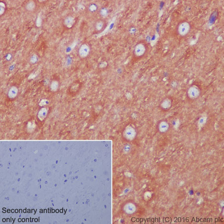 Immunohistochemistry (Formalin/PFA-fixed paraffin-embedded sections) - Anti-beta Tubulin antibody [EPR1330] - Microtubule Marker (ab108342), expandable thumbnail