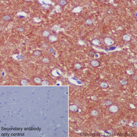 Immunohistochemistry (Formalin/PFA-fixed paraffin-embedded sections) - Anti-beta Tubulin antibody [EPR1330] - Microtubule Marker (ab108342), expandable thumbnail