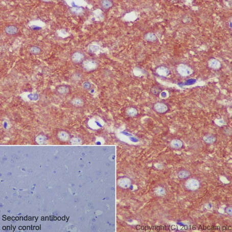 Immunohistochemistry (Formalin/PFA-fixed paraffin-embedded sections) - Anti-beta Tubulin antibody [EPR1330] - Loading Control (AB108342)
