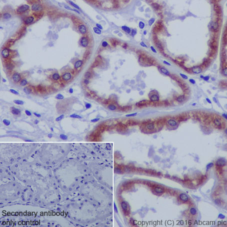 Immunohistochemistry (Formalin/PFA-fixed paraffin-embedded sections) - Anti-beta Tubulin antibody [EPR1330] - Microtubule Marker (AB108342), expandable thumbnail