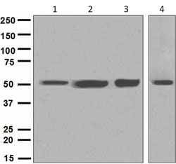 Western blot - Anti-beta Tubulin antibody [EPR1330] - Loading Control (ab108342), expandable thumbnail