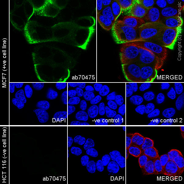 Immunocytochemistry/ Immunofluorescence - Anti-beta Tubulin antibody [EPR16774] (ab179513), expandable thumbnail
