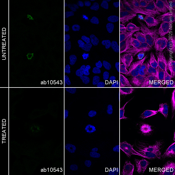 Immunocytochemistry/ Immunofluorescence - Anti-beta Tubulin antibody [EPR16774] - Loading Control (AB179513)