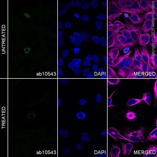 Immunocytochemistry/ Immunofluorescence - Anti-beta Tubulin antibody [EPR16774] - Loading Control (AB179513)