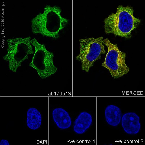 Immunocytochemistry/ Immunofluorescence - Anti-beta Tubulin antibody [EPR16774] (AB179513), expandable thumbnail