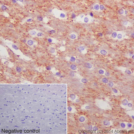 Immunohistochemistry (Formalin/PFA-fixed paraffin-embedded sections) - Anti-beta Tubulin antibody [EPR16774] (ab179513), expandable thumbnail