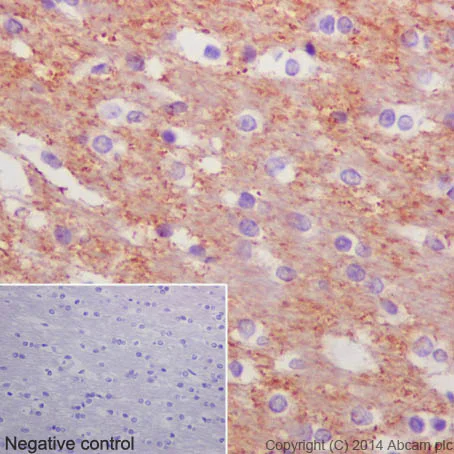 Immunohistochemistry (Formalin/PFA-fixed paraffin-embedded sections) - Anti-beta Tubulin antibody [EPR16774] - Loading Control (AB179513)