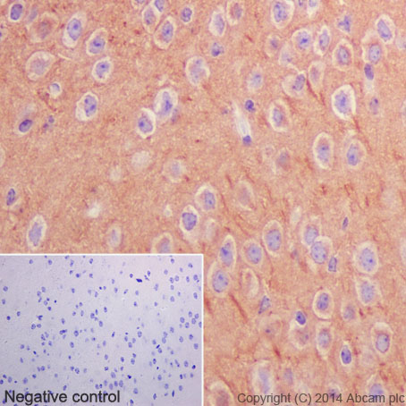 Immunohistochemistry (Formalin/PFA-fixed paraffin-embedded sections) - Anti-beta Tubulin antibody [EPR16774] (ab179513), expandable thumbnail