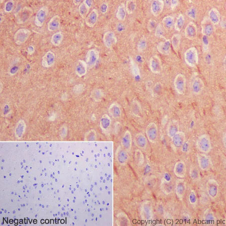 Immunohistochemistry (Formalin/PFA-fixed paraffin-embedded sections) - Anti-beta Tubulin antibody [EPR16774] - Loading Control (AB179513)