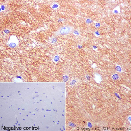 Immunohistochemistry (Formalin/PFA-fixed paraffin-embedded sections) - Anti-beta Tubulin antibody [EPR16774] (ab179513), expandable thumbnail