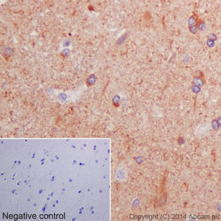 Immunohistochemistry (Formalin/PFA-fixed paraffin-embedded sections) - Anti-beta Tubulin antibody [EPR16774] (ab179513), expandable thumbnail