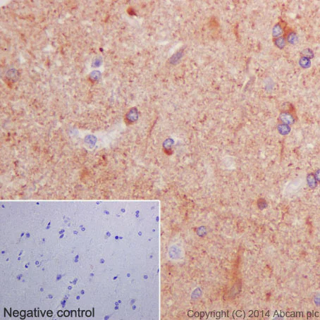 Immunohistochemistry (Formalin/PFA-fixed paraffin-embedded sections) - Anti-beta Tubulin antibody [EPR16774] - Loading Control (AB179513)