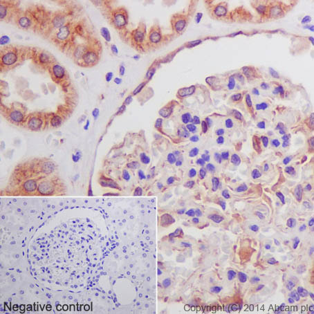 Immunohistochemistry (Formalin/PFA-fixed paraffin-embedded sections) - Anti-beta Tubulin antibody [EPR16774] (ab179513), expandable thumbnail
