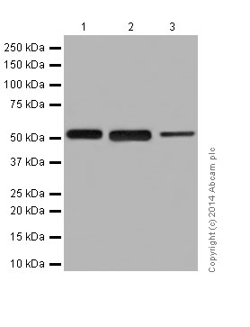 Western blot - Anti-beta Tubulin antibody [EPR16774] - Loading Control (ab179513), expandable thumbnail