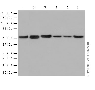 Western blot - Anti-beta Tubulin antibody [EPR16774] - Loading Control (ab179513), expandable thumbnail