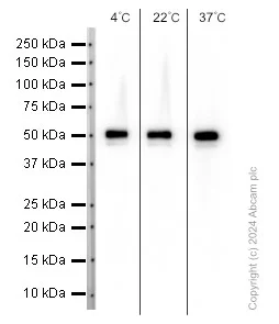 Western blot - Anti-beta Tubulin antibody [EPR16774] - Loading Control (AB179513)