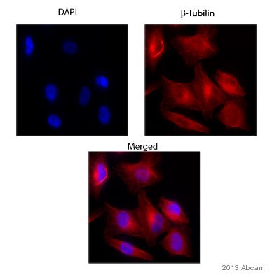 Immunocytochemistry/ Immunofluorescence - Anti-beta Tubulin antibody - Loading Control (AB15568), expandable thumbnail