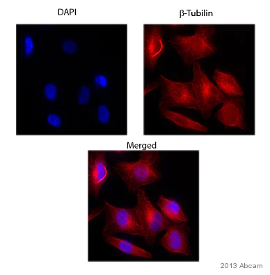 Immunocytochemistry/ Immunofluorescence - Anti-beta Tubulin antibody - Loading Control (AB15568)