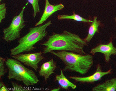Immunocytochemistry/ Immunofluorescence - Anti-beta Tubulin antibody - Loading Control (AB15568), expandable thumbnail