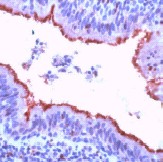 Immunohistochemistry (Formalin/PFA-fixed paraffin-embedded sections) - Anti-beta Tubulin antibody - Loading Control (AB15568), expandable thumbnail