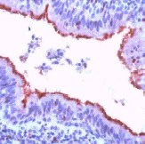 Immunohistochemistry (Formalin/PFA-fixed paraffin-embedded sections) - Anti-beta Tubulin antibody - Loading Control (AB15568)