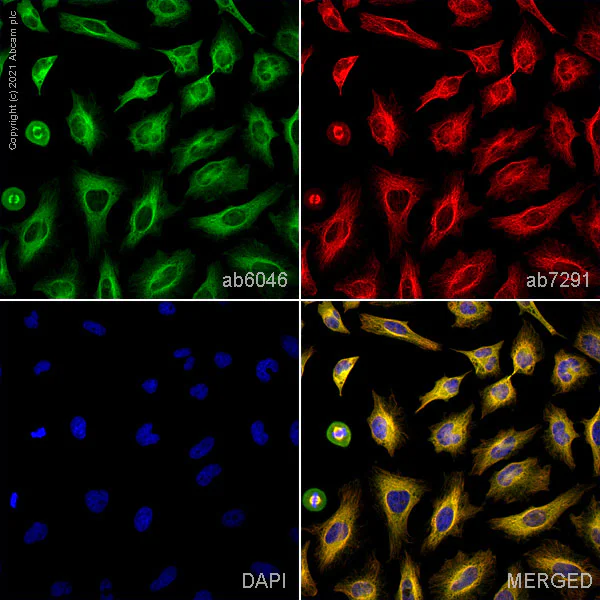 Immunocytochemistry/ Immunofluorescence - Anti-beta Tubulin antibody - Loading Control (AB6046)