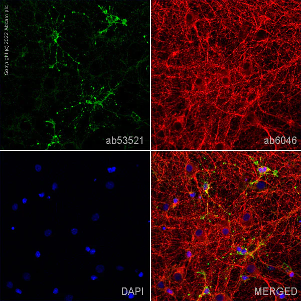 Immunocytochemistry/ Immunofluorescence - Anti-beta Tubulin antibody - Loading Control (AB6046)