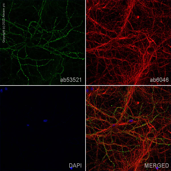 Immunocytochemistry/ Immunofluorescence - Anti-beta Tubulin antibody - Loading Control (AB6046)