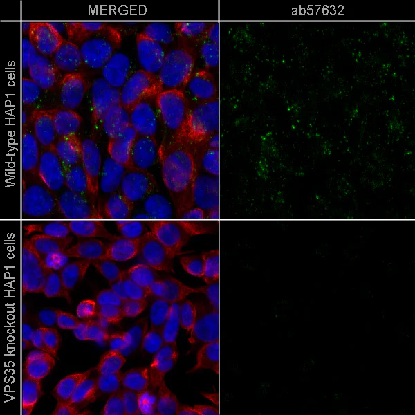 Immunocytochemistry/ Immunofluorescence - Anti-beta Tubulin antibody - Loading Control (AB6046)