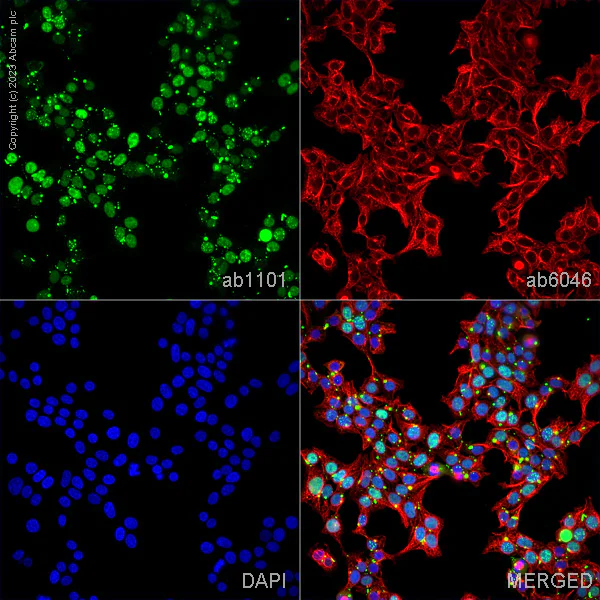 Immunocytochemistry/ Immunofluorescence - Anti-beta Tubulin antibody - Loading Control (AB6046)