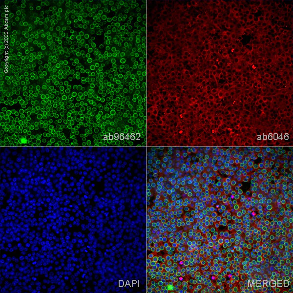 Immunocytochemistry/ Immunofluorescence - Anti-beta Tubulin antibody - Loading Control (AB6046)