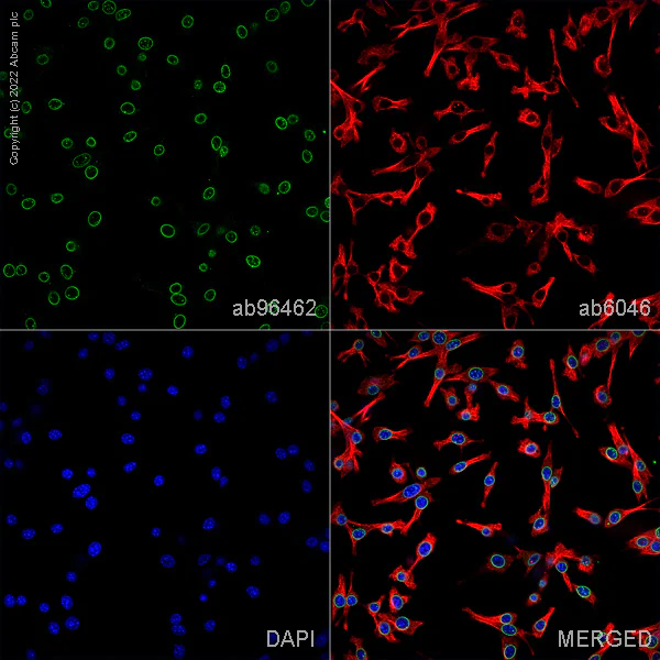 Immunocytochemistry/ Immunofluorescence - Anti-beta Tubulin antibody - Loading Control (AB6046)