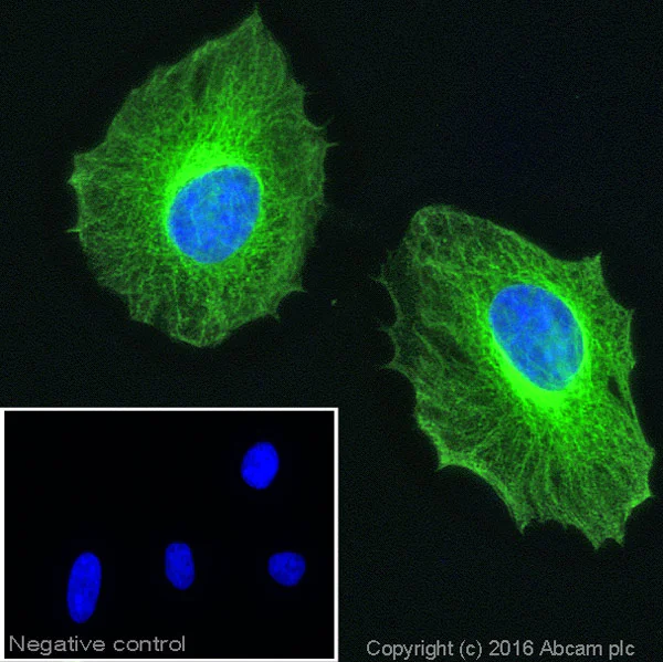 Immunocytochemistry/ Immunofluorescence - Anti-beta Tubulin antibody - Loading Control (AB6046)