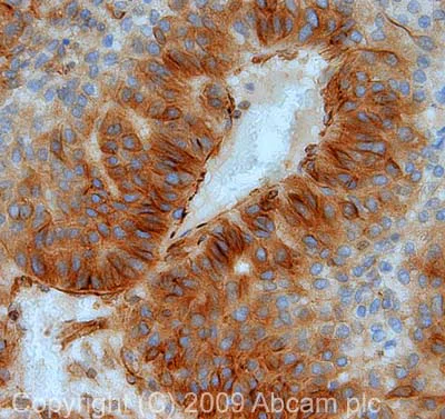 Immunohistochemistry (Formalin/PFA-fixed paraffin-embedded sections) - Anti-beta Tubulin antibody - Loading Control (AB6046)