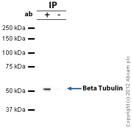 Immunoprecipitation - Anti-beta Tubulin antibody - Loading Control (AB6046)